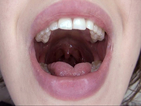 300人のおくち　3　サンプル画像09